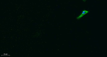 STEAP2 rabbit pAb Antibody