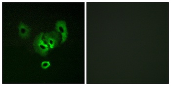 STEAP2 rabbit pAb Antibody