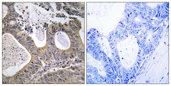 STEAP2 rabbit pAb Antibody