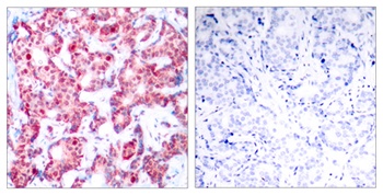 GATA-1 (phospho Ser142) rabbit pAb