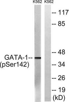 GATA-1 (phospho Ser142) rabbit pAb