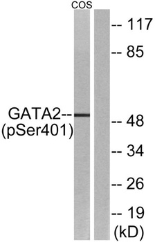 GATA-2 (phospho Ser401) rabbit pAb