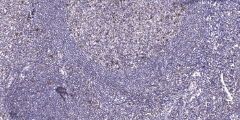 GATA-4 (phospho Ser105) rabbit pAb