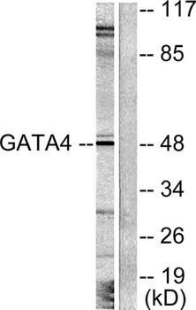 GATA-4 rabbit pAb Antibody