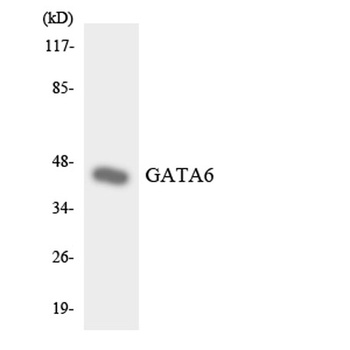 GATA-6 rabbit pAb Antibody