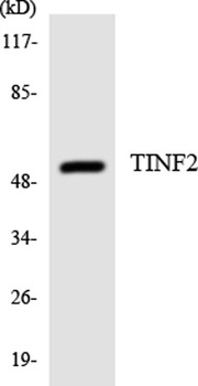 TIN2 rabbit pAb Antibody