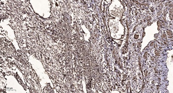 TIN2 rabbit pAb Antibody
