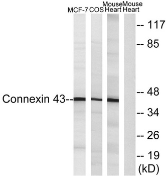 Connexin 43 rabbit pAb Antibody