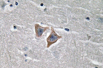 CD57 rabbit pAb Antibody