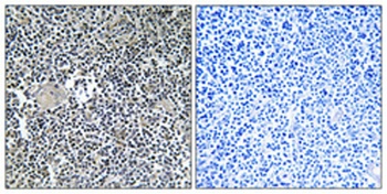 Arfaptin 1 rabbit pAb Antibody