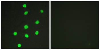 GLI-3 rabbit pAb Antibody
