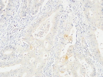 14-3-3 σ rabbit pAb Antibody