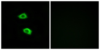 Olfactory receptor 51B5 rabbit pAb Antibody