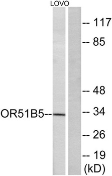 Olfactory receptor 51B5 rabbit pAb Antibody