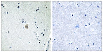 Cadherin-20 rabbit pAb Antibody