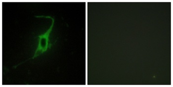 Cadherin-20 rabbit pAb Antibody