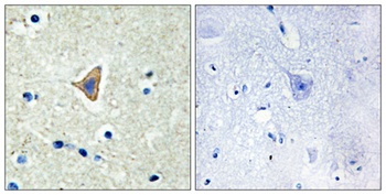 Cadherin-20 rabbit pAb Antibody