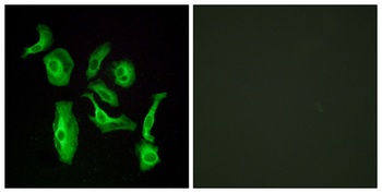 GPR133 rabbit pAb Antibody