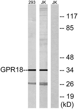 GPR18 rabbit pAb Antibody