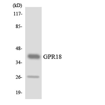 GPR18 rabbit pAb Antibody