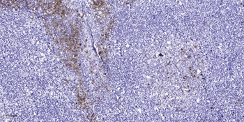 GPR18 rabbit pAb Antibody