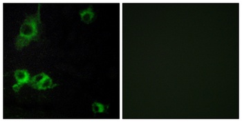 Laminin α-1 rabbit pAb Antibody