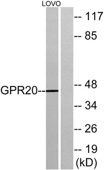 GPR20 rabbit pAb Antibody
