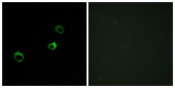 CYB561D1 rabbit pAb Antibody