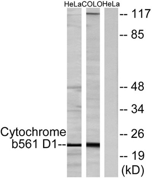 CYB561D1 rabbit pAb Antibody