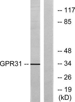 GPR31 rabbit pAb Antibody