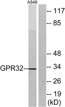 GPR32 rabbit pAb Antibody