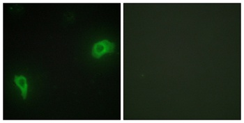 Dok-7 rabbit pAb Antibody