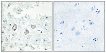 Dok-7 rabbit pAb Antibody