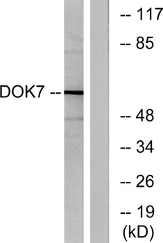 Dok-7 rabbit pAb Antibody