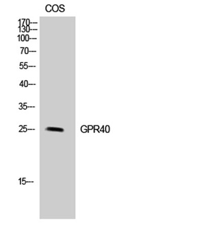 GPR40 rabbit pAb Antibody