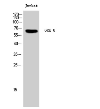 GRK 6 rabbit pAb Antibody