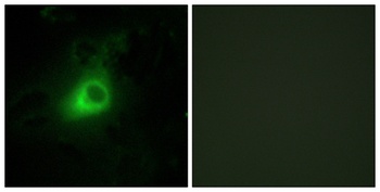 GRK 6 rabbit pAb Antibody