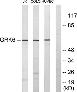 GRK 6 rabbit pAb Antibody