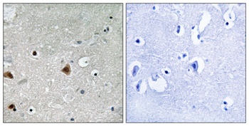 CSN1 (phospho Ser454) rabbit pAb Antibody