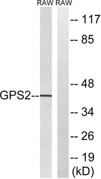 GPS2 rabbit pAb Antibody