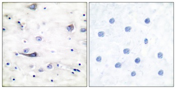 GluR-1 (phospho Ser863) rabbit pAb