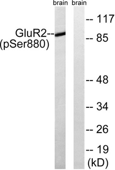 GluR-2 (phospho Ser880) rabbit pAb Antibody