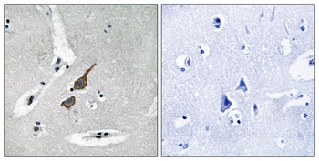 GluR-δ1 rabbit pAb Antibody