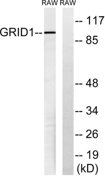 GluR-δ1 rabbit pAb Antibody