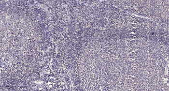 ACAD-9 rabbit pAb Antibody