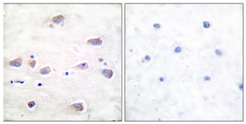NMDAζ1 (phospho Ser897) rabbit pAb
