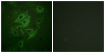 NMDAε1/2 rabbit pAb Antibody
