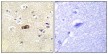 NMDAε1/2 rabbit pAb Antibody
