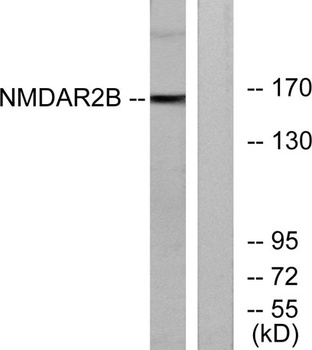 NMDAε2 rabbit pAb Antibody