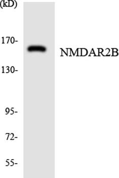 NMDAε2 rabbit pAb Antibody
